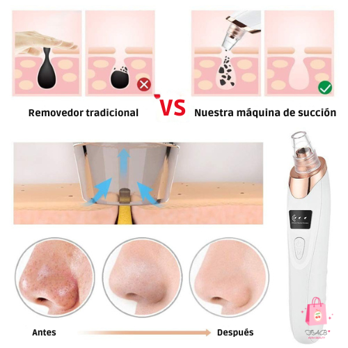 Dear Beauty- Limpiador Puntos Negros Cleaner PRO